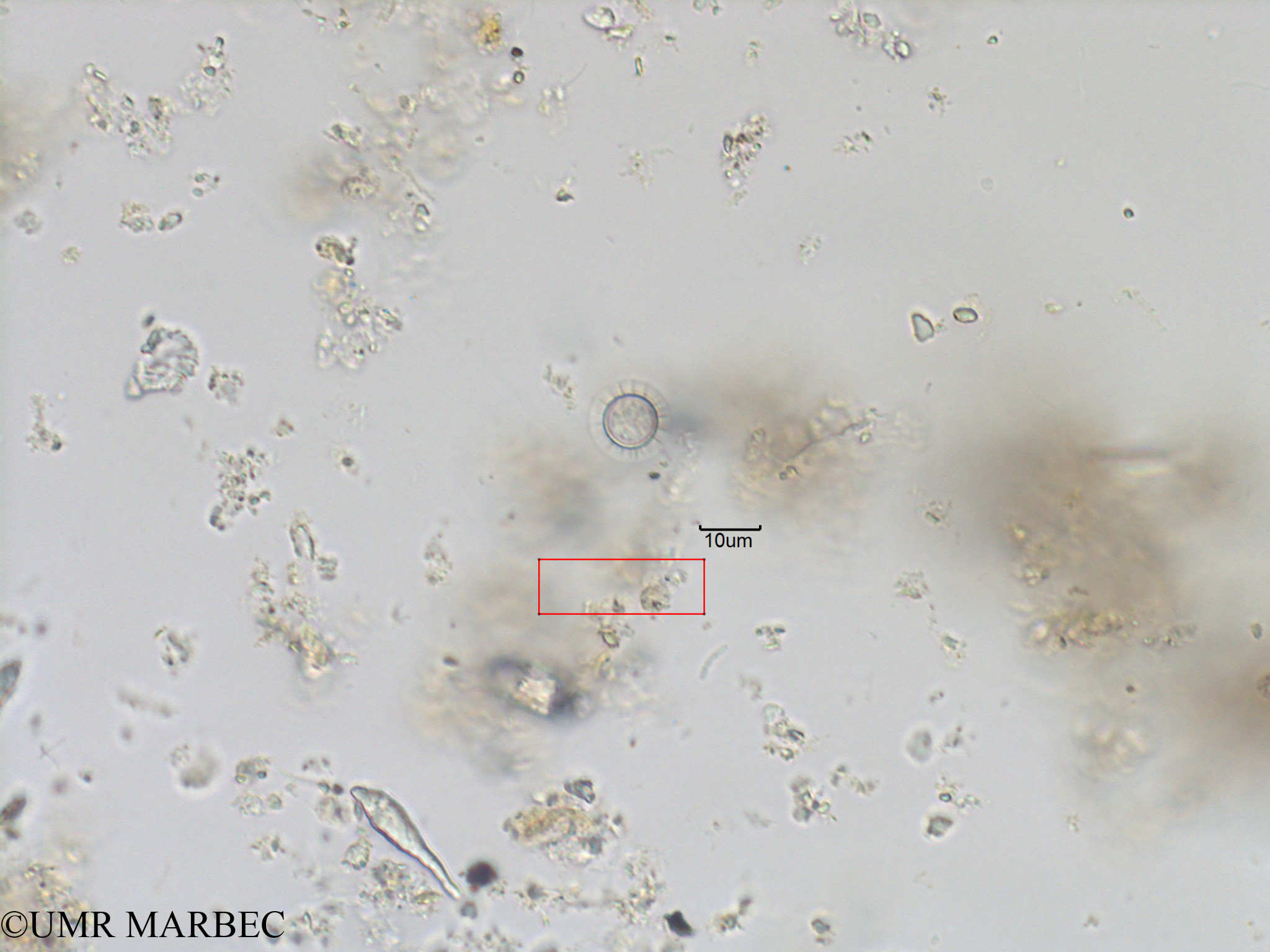 phyto/Bizerte/bizerte_bay/RISCO November 2015/Pterosperma undulatum (Baie_T1B-Diatomée cf planktoniella-2).tif(copy).jpg